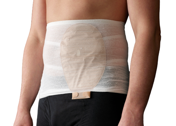 Faja Ostomía Corsinel StomaSafe Classic